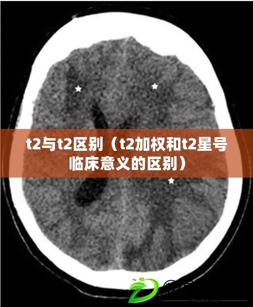 t2與t2區(qū)別（t2加權(quán)和t2星號臨床意義的區(qū)別）